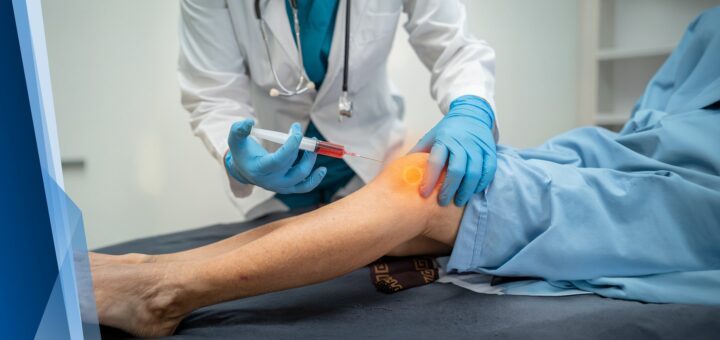 Knee Arthritis Treatment Without Surgery