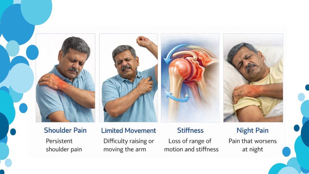Frozen Shoulder Symptoms: What Are the Symptoms of Frozen Shoulder?

