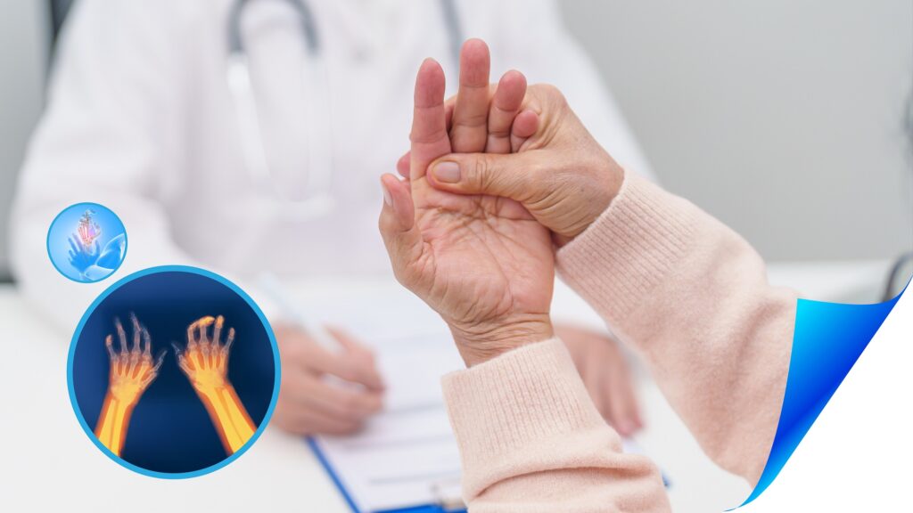 What is the Treatment for Rheumatoid Arthritis? What is the Treatment for Rheumatoid Arthritis?